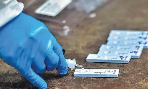 ആര്‍.ടി.പി.സി.ആര്‍ നിരക്ക് വർധിപ്പിക്കണമെന്ന് സ്വകാര്യ ലാബുകള്‍; മുഖ്യമന്ത്രിക്ക് കത്ത് നല്‍കും