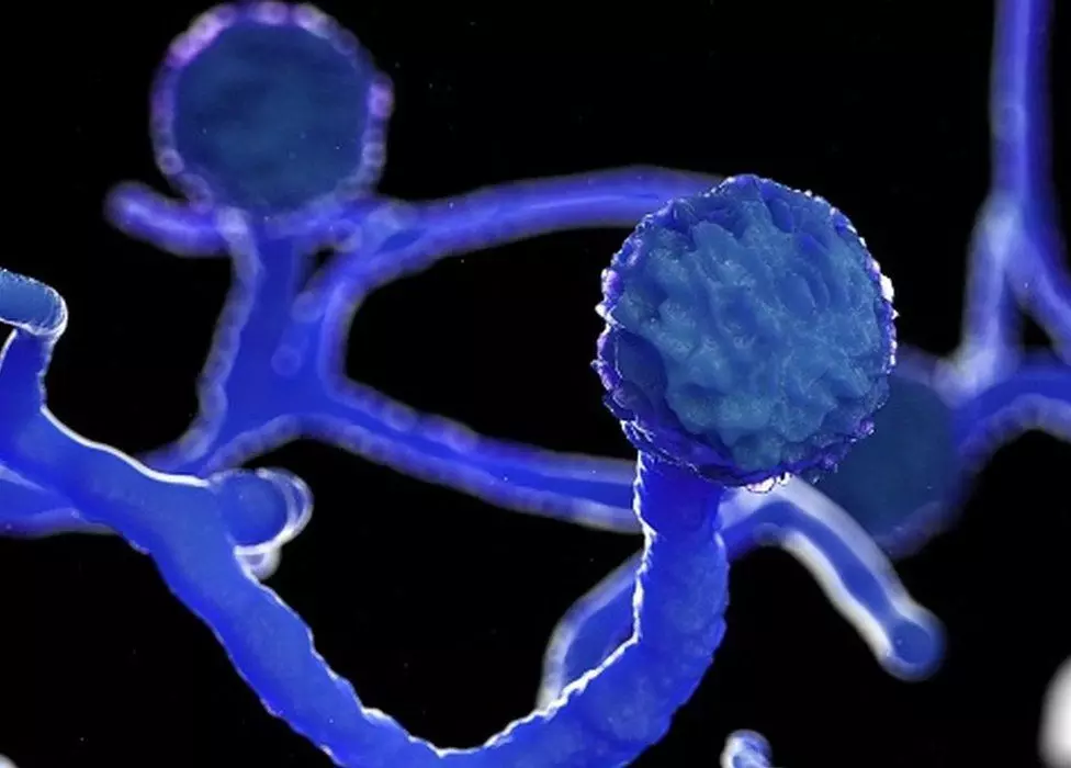 ബ്ലാക്ക് ഫംഗസ് ബാധിച്ച ഭർത്താവിന് ഇൻജക്ഷൻ നൽകിയില്ല; ആശുപത്രി കെട്ടിടത്തിൽനിന്ന് ചാടി ആത്മഹത്യ ചെയ്യുമെന്ന് യുവതിയുടെ ഭീഷണി