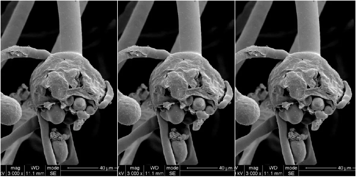 സംസ്ഥാനത്ത് വീണ്ടും ബ്ലാക് ഫംഗസ് മരണം