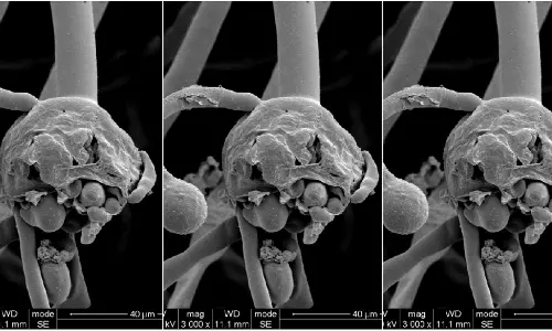 സംസ്ഥാനത്ത് വീണ്ടും ബ്ലാക് ഫംഗസ് മരണം