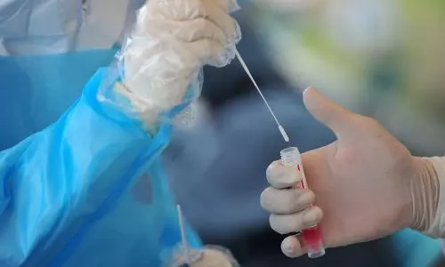 കോവിഡ് പരിശോധനക്കായി സ്രവമെടുക്കുന്നതിനിടെ സ്ത്രീയുടെ മൂക്കിന് പരിക്കേറ്റു; ഡോക്ടര്‍ക്ക് കൂട്ടമര്‍ദ്ദനം