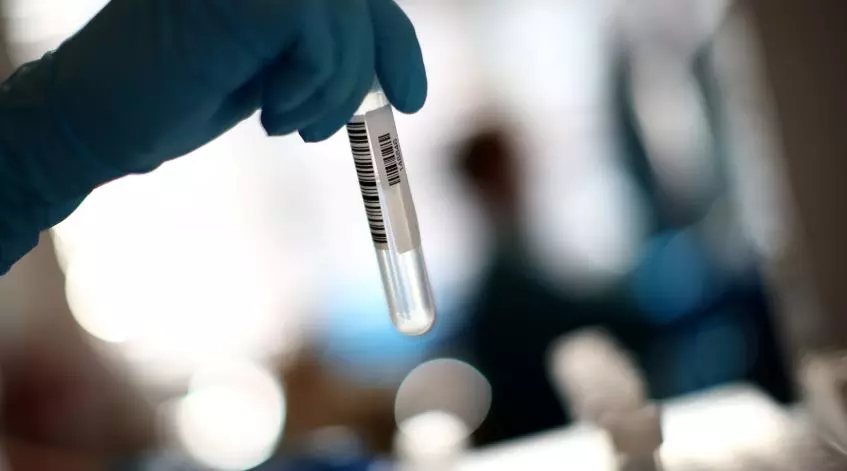 ബഹ്റൈനിൽ കോവിഡ് രോഗികളുടെ എണ്ണത്തിലും മരണ നിരക്കിലും വർധന ബഹ്റൈനിൽ കോവിഡ് രോഗികളുടെ എണ്ണത്തിലും മരണ നിരക്കിലും വർധന