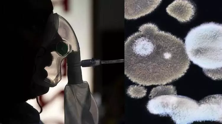 സംസ്ഥാനത്ത് ബ്ലാക്ക് ഫംഗസ് മരുന്ന് ക്ഷാമം രൂക്ഷം