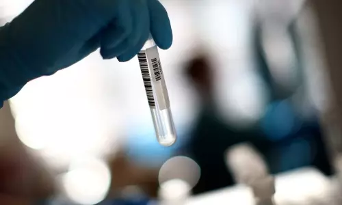 ബഹ്റൈനിൽ കോവിഡ് രോഗികളുടെ എണ്ണത്തിലും മരണ നിരക്കിലും വർധന ബഹ്റൈനിൽ കോവിഡ് രോഗികളുടെ എണ്ണത്തിലും മരണ നിരക്കിലും വർധന