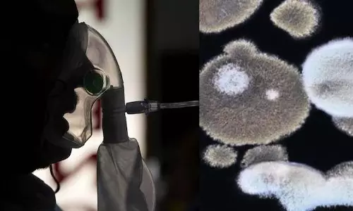 സംസ്ഥാനത്ത് ബ്ലാക്ക് ഫംഗസ് മരുന്ന് ക്ഷാമം രൂക്ഷം