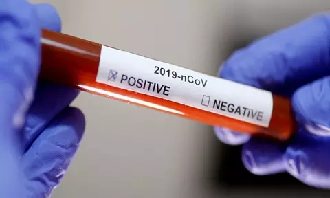 ചികിത്സ കേന്ദ്രത്തിൽ നിന്ന് ഇറക്കിവിട്ടു; സെക്രട്ടേറിയറ്റിന് മുന്നിൽ കോവിഡ് രോഗികളുടെ പ്രതിഷേധം ചികിത്സ കേന്ദ്രത്തിൽ നിന്ന് ഇറക്കിവിട്ടു; സെക്രട്ടേറിയറ്റിന് മുന്നിൽ കോവിഡ് രോഗികളുടെ പ്രതിഷേധം