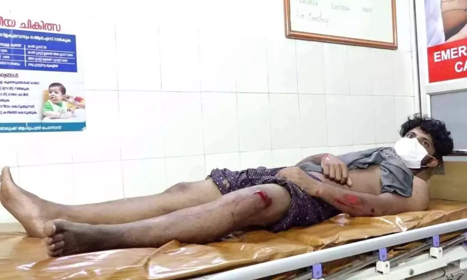 വീടിന് മുന്നില്‍ നില്‍ക്കുകയായിരുന്ന യുവാവിന് പൊലീസിന്റെ ക്രൂരമര്‍ദനം