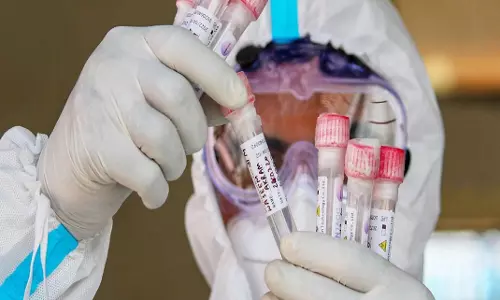 ചൈനയിൽ H10N3 വൈറസ് മനുഷ്യരിൽ സ്ഥിരീകരിച്ചു; ലോകത്ത് ആദ്യം