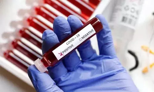 മൈലാബിന്റെ കോവിഡ് സെല്‍ഫ് ടെസ്റ്റിങ് കിറ്റ് രണ്ട് ദിവസത്തിനുള്ളില്‍ വിപണിയിലെത്തും