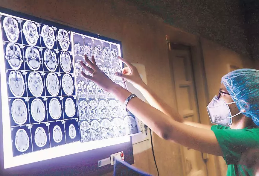 തമിഴ്​നാട്ടിൽ 921 പേർക്ക്​ ബ്ലാക്​ ഫംഗസ്​; ഇ​രു​പ​തി​ല​ധി​കം രോ​ഗി​ക​ൾ മ​രി​ച്ചു