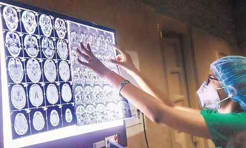 തമിഴ്​നാട്ടിൽ 921 പേർക്ക്​ ബ്ലാക്​ ഫംഗസ്​; ഇ​രു​പ​തി​ല​ധി​കം രോ​ഗി​ക​ൾ മ​രി​ച്ചു