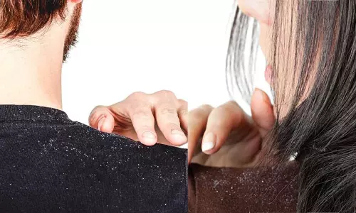 താരനാണോ പ്രശ്നം?, മാറ്റാൻ വഴിയുണ്ട്..