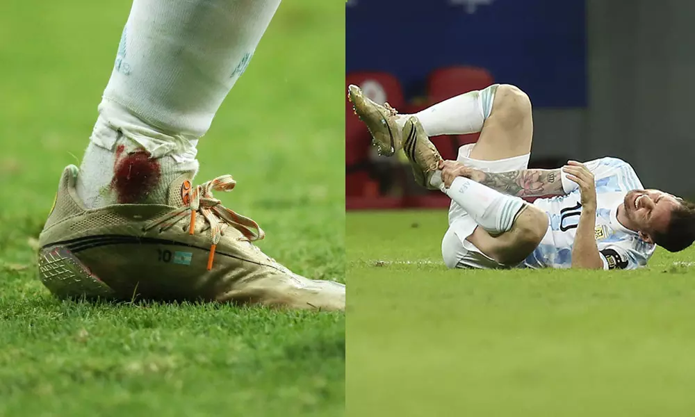 കണങ്കാലിൽ ചോരയൊലിച്ചു, വേദന കൊണ്ടു പുളഞ്ഞു; എന്നിട്ടും തിരിച്ചു കയറാതെ, സമർപ്പണത്തിന്റെ ആൾരൂപമായി മെസ്സി