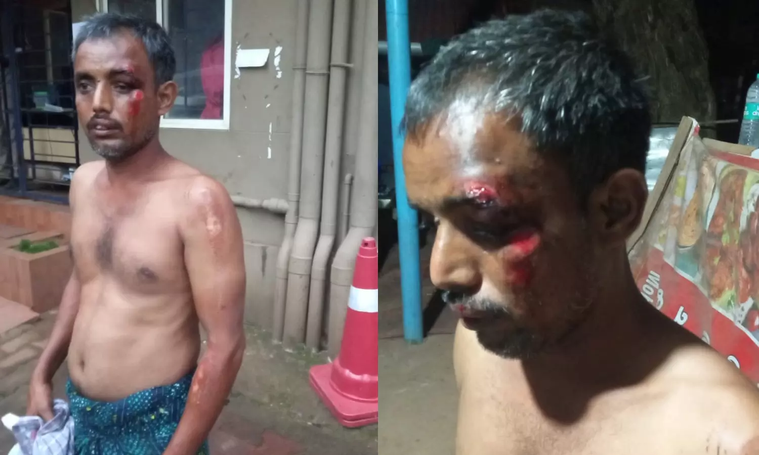 കൊടുവള്ളിയില് വീണ്ടും കവര്ച്ചാസംഘം അതിഥി തൊഴിലാളിയെ ബൈക്കില് വലിച്ചിഴച്ചു കൊടുവള്ളിയില് വീണ്ടും കവര്ച്ചാസംഘം അതിഥി തൊഴിലാളിയെ ബൈക്കില് വലിച്ചിഴച്ചു