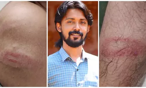 മാധ്യമം ലേഖകന് പൊലീസ് മർദനം: കേസെടുത്ത് മനുഷ്യാവകാശ കമ്മീഷൻ; അന്വേഷണത്തിന് ഉത്തരവിട്ടു