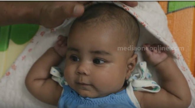 ഇശല്‍ മറിയത്തിന്‍റെ ചികിത്സക്കായി ഇതുവരെ ലഭിച്ചത് രണ്ട് കോടി 84 ലക്ഷം രൂപ