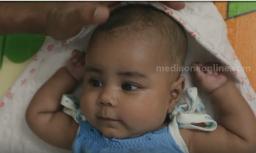 ഇശല്‍ മറിയത്തിന്‍റെ ചികിത്സക്കായി ഇതുവരെ ലഭിച്ചത് രണ്ട് കോടി 84 ലക്ഷം രൂപ