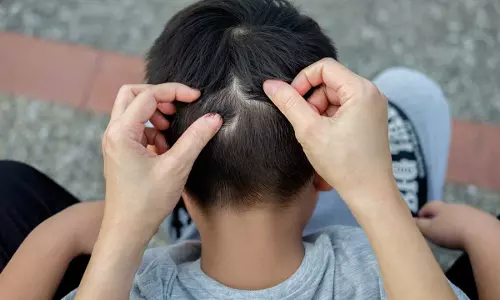 കുട്ടികളുടെ തല മുട്ടിയാൽ ഉടന്‍ ശ്രദ്ധിക്കേണ്ട കാര്യങ്ങൾ