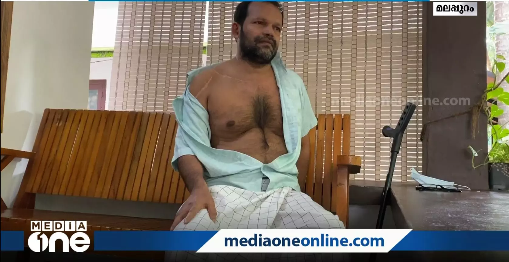 കരിപ്പൂര്‍ വിമാനപകടത്തിന് ഒരു വര്‍ഷം; പരിക്കേറ്റ പലരും ഇന്നും ചികിത്സ തുടരുന്നു