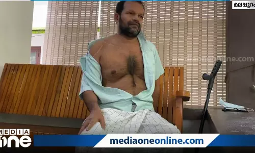 കരിപ്പൂര് വിമാനപകടത്തിന് ഒരു വര്ഷം; പരിക്കേറ്റ പലരും ഇന്നും ചികിത്സ തുടരുന്നു കരിപ്പൂര് വിമാനപകടത്തിന് ഒരു വര്ഷം; പരിക്കേറ്റ പലരും ഇന്നും ചികിത്സ തുടരുന്നു