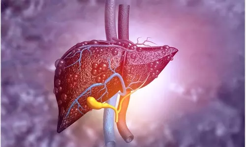 ഈ കാരണങ്ങളാണ് നമ്മളെ കരൾ രോഗി ആക്കുന്നത്..