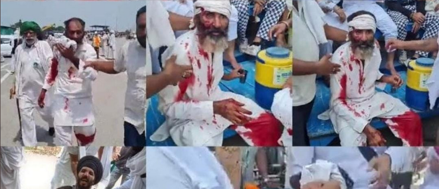 ഹരിയാനയില്‍ പൊലീസ് നടപടിക്കിടെ പരിക്കേറ്റ കര്‍ഷകന്‍ മരിച്ചു