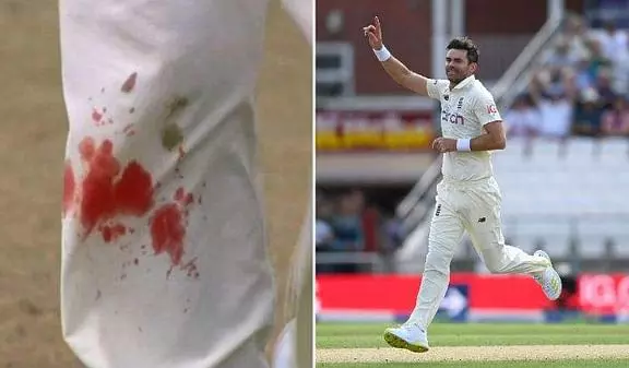 ചോരയൊലിക്കുന്ന കാലുകളുമായി കളിക്കളം നിറഞ്ഞ് ആന്‍ഡേഴ്സന്‍; പ്രശംസിച്ച് ക്രിക്കറ്റ് ലോകം