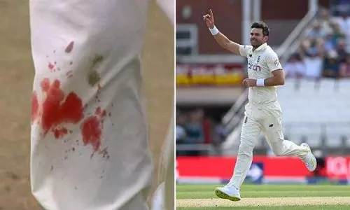 ചോരയൊലിക്കുന്ന കാലുകളുമായി കളിക്കളം നിറഞ്ഞ് ആന്‍ഡേഴ്സന്‍; പ്രശംസിച്ച് ക്രിക്കറ്റ് ലോകം