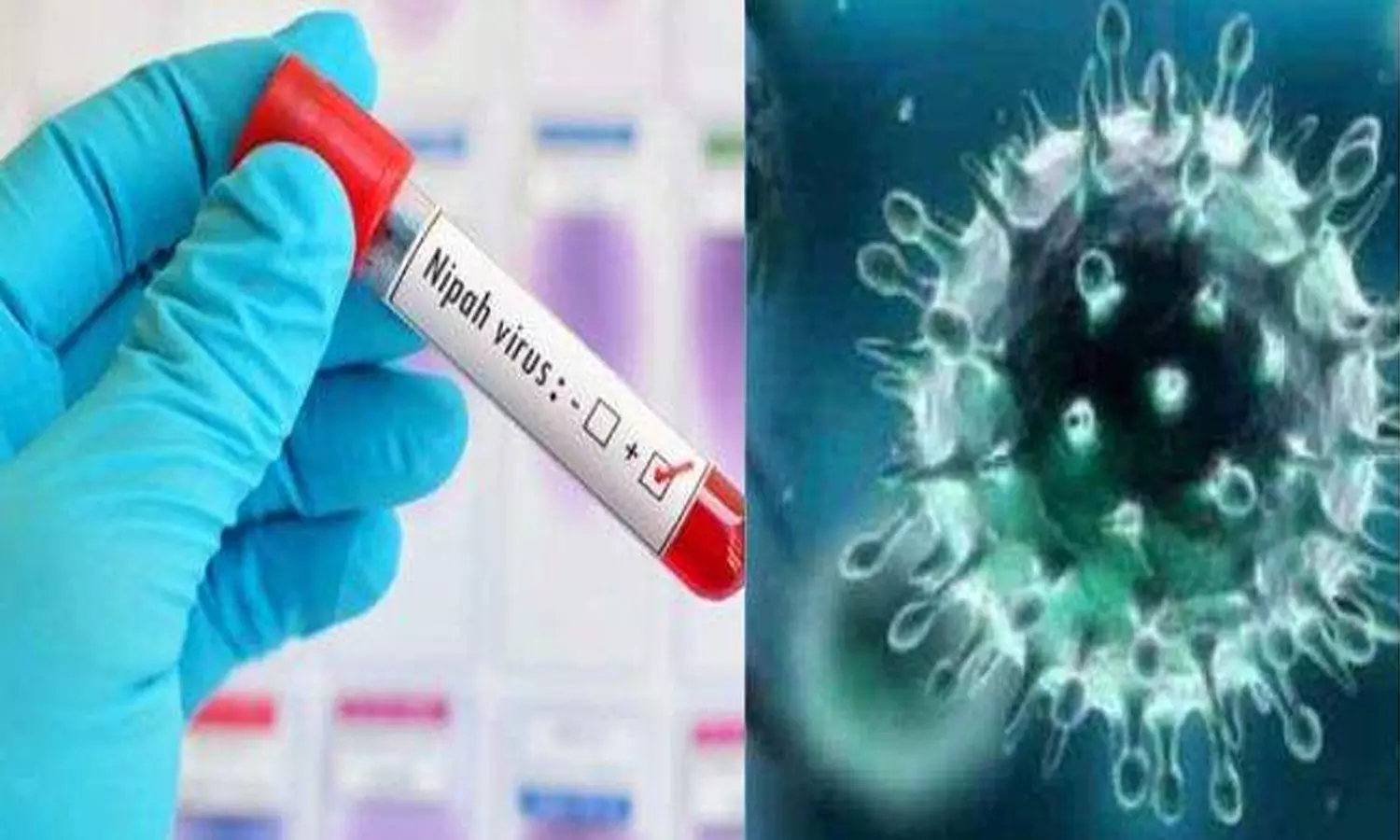 കോഴിക്കോട്ട് വീണ്ടും നിപ വൈറസ് സ്ഥിരീകരിച്ചു കോഴിക്കോട്ട് വീണ്ടും നിപ വൈറസ് സ്ഥിരീകരിച്ചു