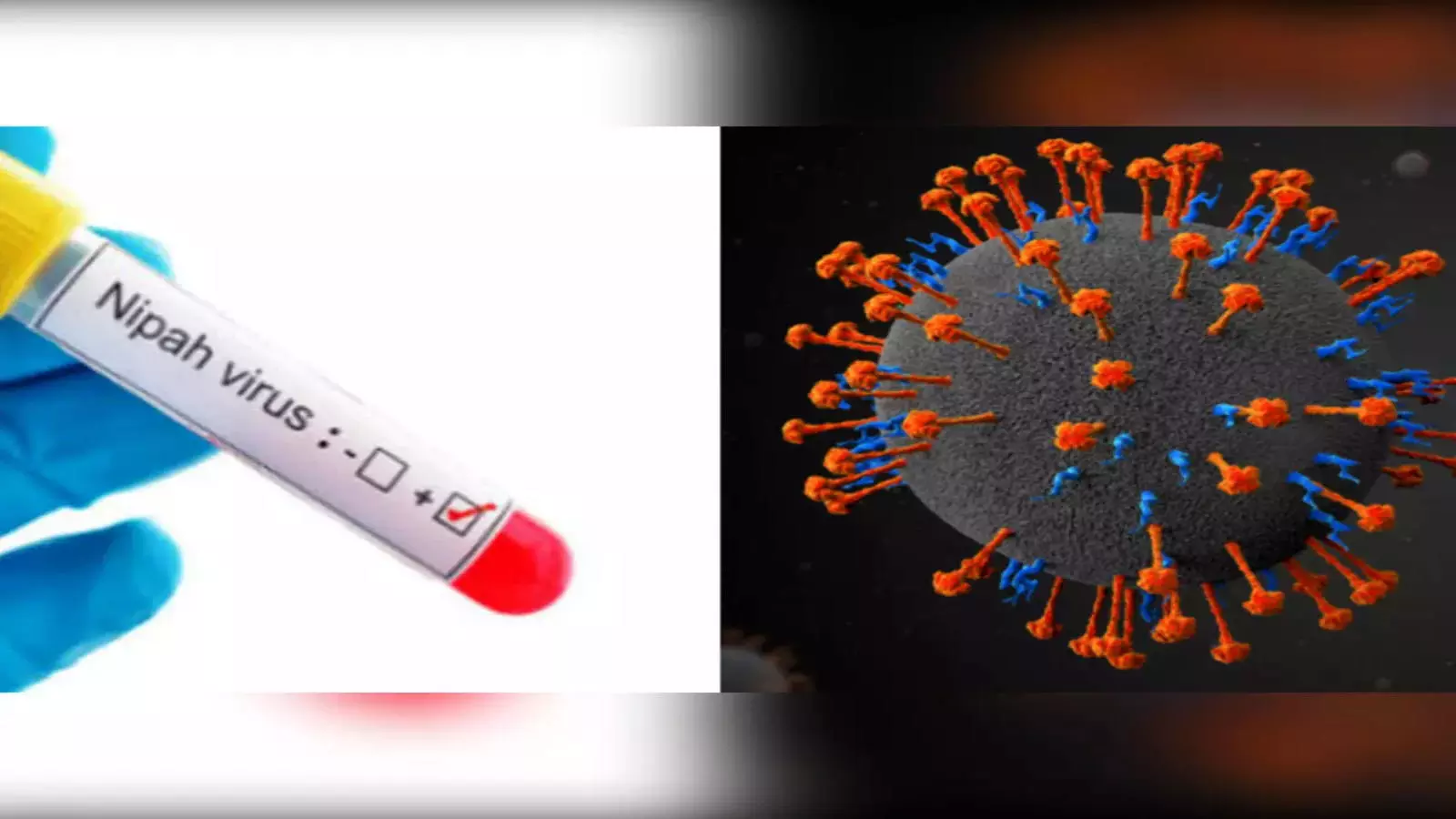 നിപയുടെ ഉറവിടം കണ്ടെത്താനായി ശേഖരിച്ച സാമ്പിളുകൾ ഭോപ്പാലിലെ ലാബിലേക്ക് അയക്കും നിപയുടെ ഉറവിടം കണ്ടെത്താനായി ശേഖരിച്ച സാമ്പിളുകൾ ഭോപ്പാലിലെ ലാബിലേക്ക് അയക്കും