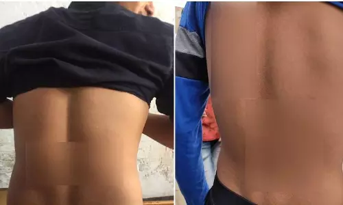 ഹരിയാനയില്‍ 40 വിദ്യാര്‍ഥികള്‍ക്ക് അധ്യാപകരുടെ ക്രൂരമര്‍ദനം; 10 കുട്ടികള്‍ ആശുപത്രിയില്‍