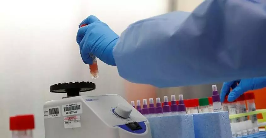 എറണാകുളത്ത് കോവിഡ് പരിശോധന നടത്തുന്ന സ്വകാര്യ ലാബുകളില്‍ റെയ്ഡ്