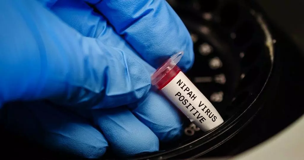 നിപ; കൂടുതല് പേരുടെ പരിശോധനാഫലം ഇന്ന്, വവ്വാലുകളുടെ സാമ്പിള് ശേഖരണവും ആരംഭിക്കും നിപ; കൂടുതല് പേരുടെ പരിശോധനാഫലം ഇന്ന്, വവ്വാലുകളുടെ സാമ്പിള് ശേഖരണവും ആരംഭിക്കും