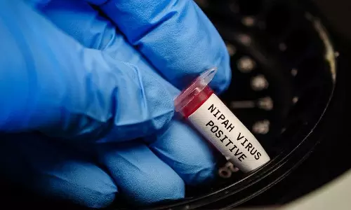 നിപ; കൂടുതല്‍ പേരുടെ പരിശോധനാഫലം ഇന്ന്, വവ്വാലുകളുടെ സാമ്പിള്‍ ശേഖരണവും ആരംഭിക്കും