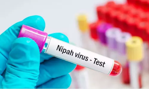 നിപ; 17 പേരുടെ പരിശോധനാഫലം കൂടി നെഗറ്റീവ് നിപ; 17 പേരുടെ പരിശോധനാഫലം കൂടി നെഗറ്റീവ്