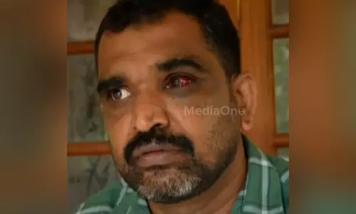 അതിഥി തൊഴിലാളിയെ കയ്യേറ്റം ചെയ്തത് ചോദ്യം ചെയ്തു; വിമുക്ത ഭടന് സംഘം ചേര്‍ന്ന് മര്‍ദനം