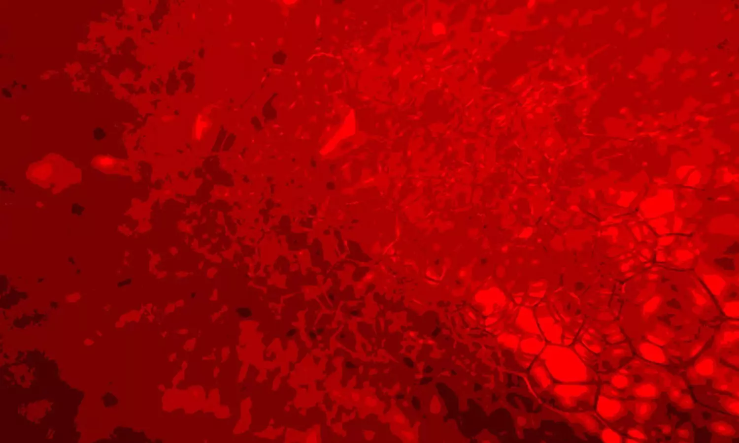 ഇൻഷൂറൻസ് തുകയായി 24 കോടി ലഭിക്കാൻ 54കാരൻ ഇരുകാലുകളും വെട്ടിമാറ്റി