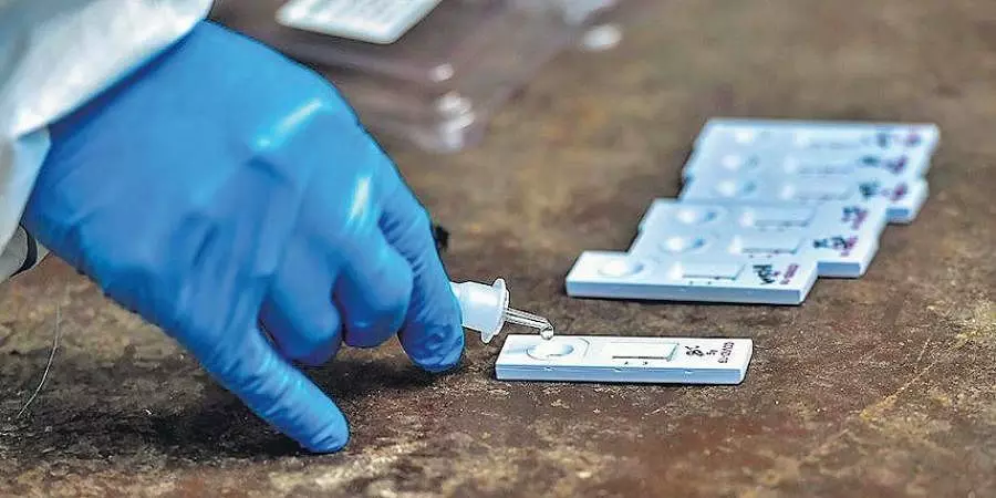 സംസ്ഥാനത്ത് കോവിഡ് നിരക്ക് താഴോട്ട്; ഇന്ന് സ്ഥിരീകരിച്ചത് 3,698 പേർക്ക് സംസ്ഥാനത്ത് കോവിഡ് നിരക്ക് താഴോട്ട്; ഇന്ന് സ്ഥിരീകരിച്ചത് 3,698 പേർക്ക്