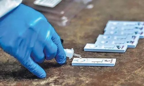 സംസ്ഥാനത്ത് കോവിഡ് നിരക്ക് താഴോട്ട്; ഇന്ന് സ്ഥിരീകരിച്ചത് 3,698 പേർക്ക്