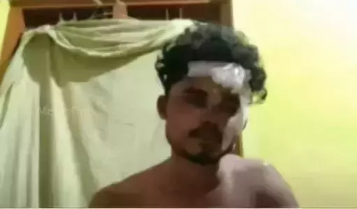 കണിയാപുരത്ത് യുവാവിനെ മർദിച്ച സംഭവം; മൊഴി രേഖപ്പെടുത്താതെ പ്രതിക്ക് ജാമ്യം, പൊലീസിന് ഗുരുതര വീഴ്ച