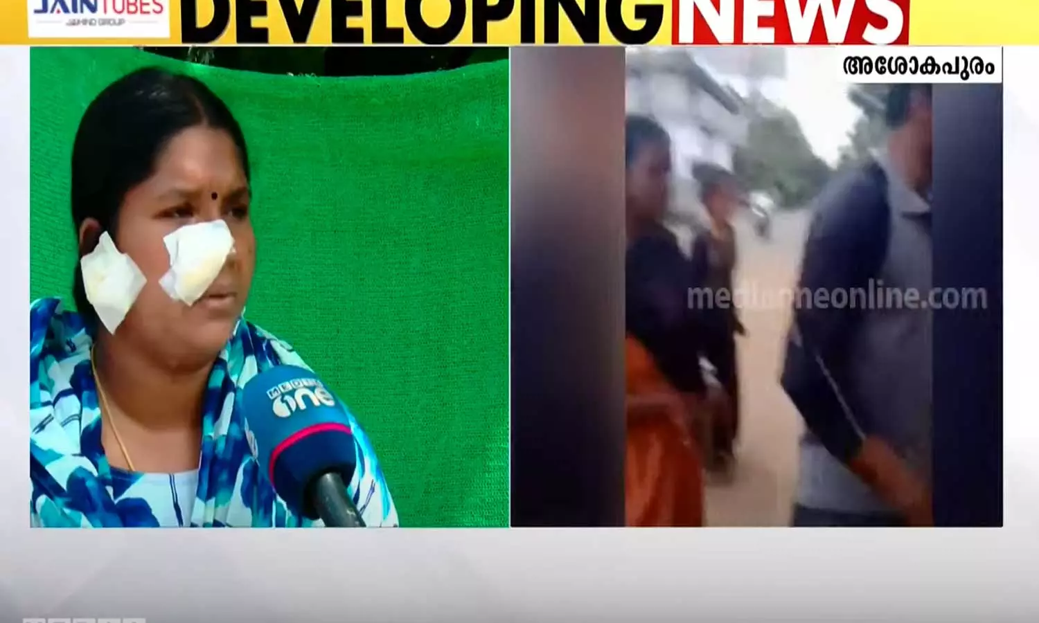 കോഴിക്കോട് ഭർത്താവ് ഭാര്യയെ മർദിച്ച സംഭവം; മുമ്പ് പരാതി നൽകിയിട്ടും പൊലീസ് നടപടി എടുത്തിരുന്നില്ലെന്ന് പരാതി കോഴിക്കോട് ഭർത്താവ് ഭാര്യയെ മർദിച്ച സംഭവം; മുമ്പ് പരാതി നൽകിയിട്ടും പൊലീസ് നടപടി എടുത്തിരുന്നില്ലെന്ന് പരാതി