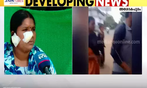 കോഴിക്കോട്  ഭർത്താവ് ഭാര്യയെ മർദിച്ച സംഭവം; മുമ്പ് പരാതി നൽകിയിട്ടും പൊലീസ് നടപടി എടുത്തിരുന്നില്ലെന്ന് പരാതി