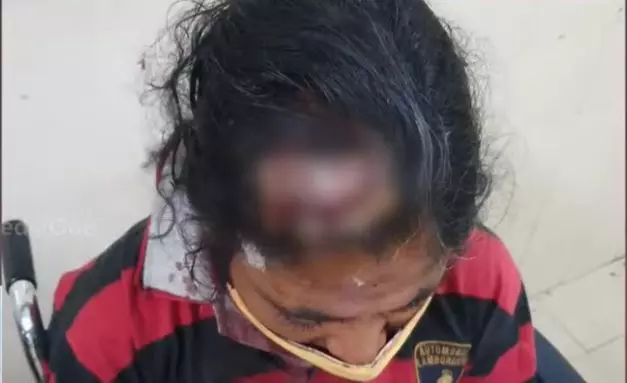 പുരയിടത്തിൽ പുലർച്ചെ റോഡ് വെട്ടാൻ ശ്രമം; തടഞ്ഞ യുവതിക്ക് നേരെ ആക്രമണം