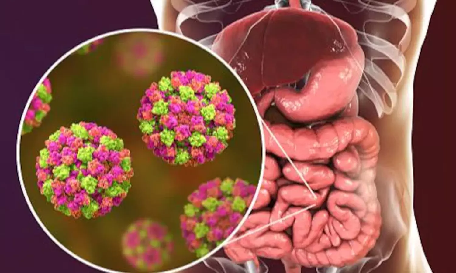 തൃശൂരിൽ 52 പേർക്ക് നോറോ വൈറസ് സ്ഥിരീകരിച്ചു; കനത്ത ജാഗ്രത തൃശൂരിൽ 52 പേർക്ക് നോറോ വൈറസ് സ്ഥിരീകരിച്ചു; കനത്ത ജാഗ്രത