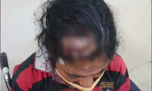 പുരയിടത്തിൽ പുലർച്ചെ റോഡ് വെട്ടാൻ ശ്രമം; തടഞ്ഞ യുവതിക്ക് നേരെ ആക്രമണം