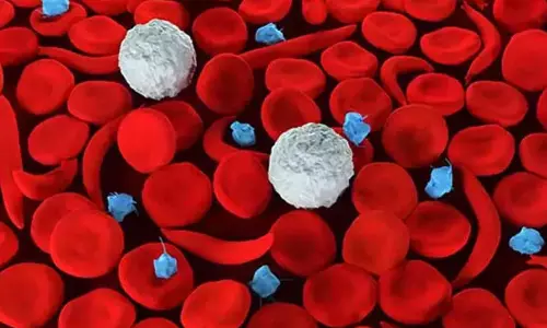 അട്ടപ്പാടിയിൽ അരിവാൾ രോഗികൾ പ്രസവിക്കരുതെന്ന് നിർദേശം