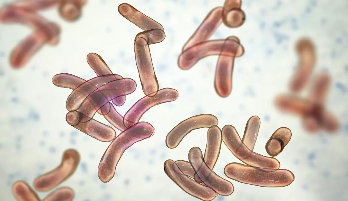 കോഴിക്കോട് ജില്ലയിൽ  37 വയസ്സുകാരന് കോളറ