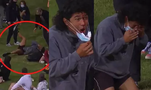 ആരാധകന്റെ മുഖം തകർത്ത സിക്‌സർ: ചോരയൊലിച്ച് ടെലിവിഷൻ സ്‌ക്രീനിൽ...