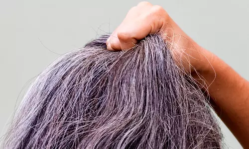 മുടിയിലെ നരയാണോ  പ്രശ്‌നം? വീട്ടിലുണ്ട് പരിഹാരം