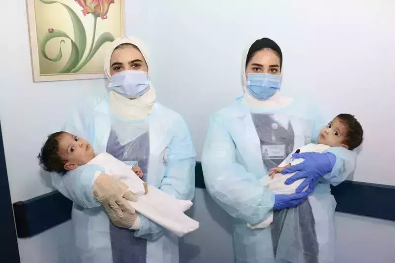 ഒറ്റ ഉടലായി വന്ന്, ഇരു ഉടലുകളായി തിരിച്ചു പോയി; യെമന് ഇരട്ടകളുടെ ശസ്ത്രക്രിയ വിജയകരം ഒറ്റ ഉടലായി വന്ന്, ഇരു ഉടലുകളായി തിരിച്ചു പോയി; യെമന് ഇരട്ടകളുടെ ശസ്ത്രക്രിയ വിജയകരം